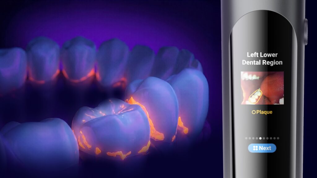 Beyond the Smart Toothbrush: usmile Brings Visual Technology to At-Home Oral Care, Healthy Living + Travel