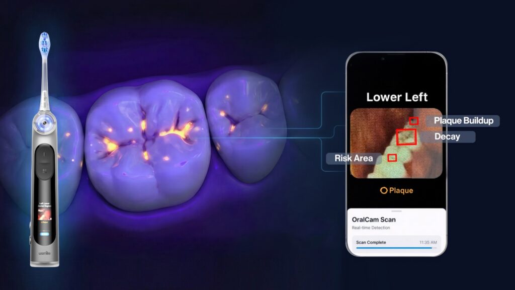Beyond the Smart Toothbrush: usmile Brings Visual Technology to At-Home Oral Care, Healthy Living + Travel